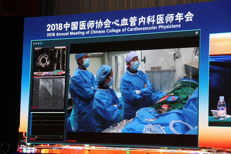 轻舟藥物球囊羊城收获赞誉 6年与30秒展现中国力量与中国自信