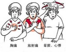 冠心病有哪些症狀亚洲中文字幕无码一久久区国产看真人毛片爱做A片亚洲精品国产第一区第二区?