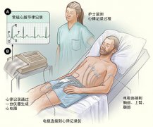 冠心病需要做哪些檢查亚洲永久精品日本无码国产看真人毛片爱做A片国产精品偷伦视频播放?