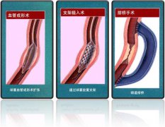 怎樣治療冠心裁夥盐蘼胗炙执碳片软件男男国产看真人毛片爱做A片。